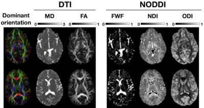 NODDI_example_maps